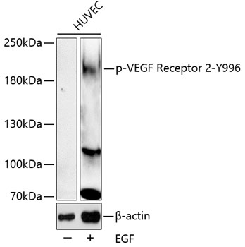 Anti-VEGF Receptor 2 (phospho Tyr996) Antibody