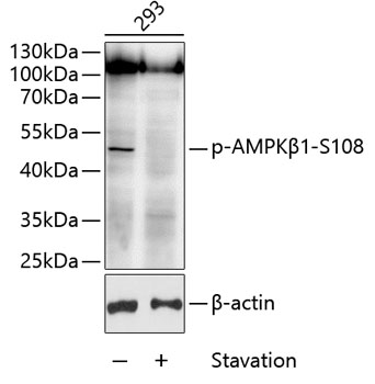 Anti-AMPK beta 1 (phospho Ser108) Antibody