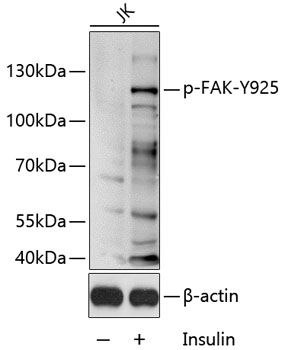 Anti-FAK (phospho Tyr925) Antibody