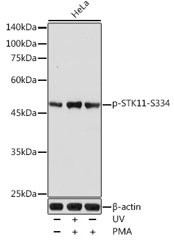 Anti-LKB1 (phospho Ser334) Antibody