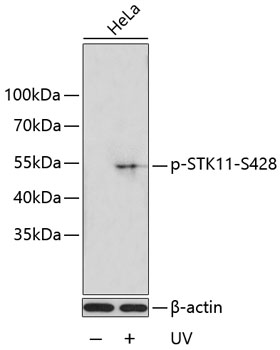 Anti-LKB1 (phospho Ser428) Antibody