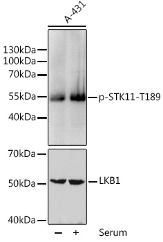 Anti-LKB1 (phospho Thr189) Antibody