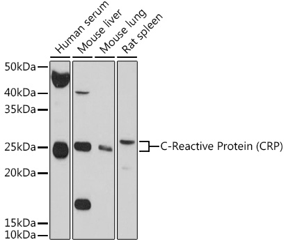 Anti-C Reactive Protein Antibody