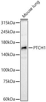 Anti-Patched / PTCH1 Antibody