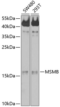 Anti-Prostate Secretory Protein / PSP Antibody