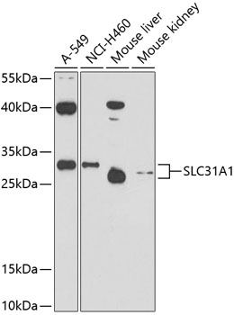 Anti-SLC31A1 / CTR1 Antibody