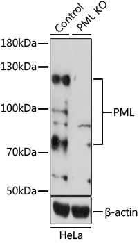 Anti-PML Protein Antibody