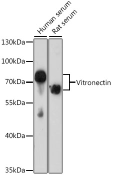 Anti-Vitronectin / S-Protein Antibody