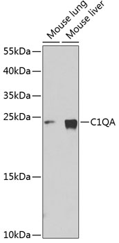 Anti-C1QA Antibody