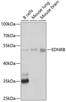 Anti-Endothelin B Receptor / ET-B Antibody