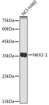 Anti-TTF1 Antibody