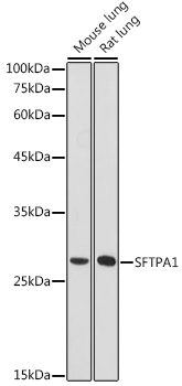 Anti-Surfactant Protein A / PSAP Antibody