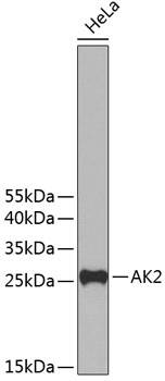 Anti-AK2 Antibody