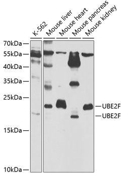 Anti-UBE2F Antibody