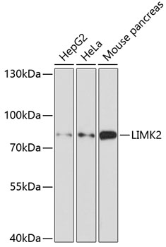 Anti-LIMK2 Antibody