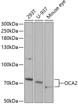 Anti-OCA2 Antibody