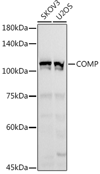 Anti-COMP / Cartilage oligomeric matrix protein Antibody