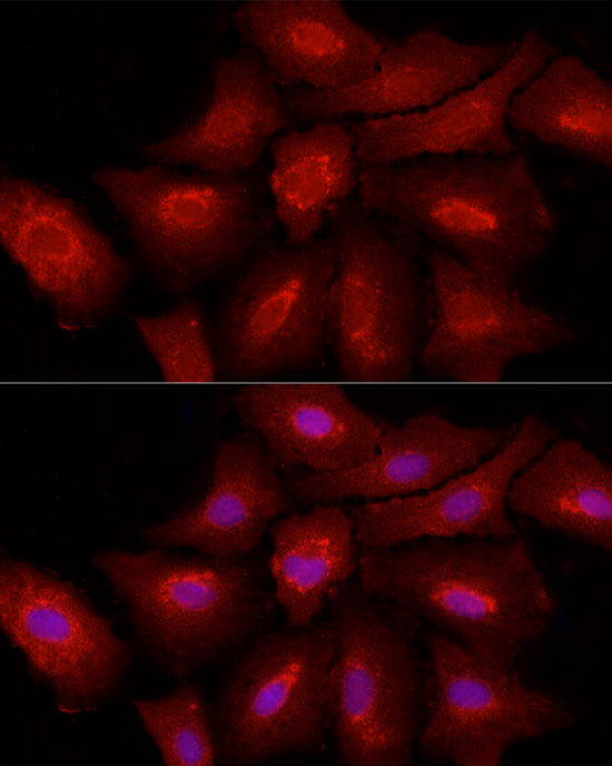 Anti-Fibroblast activation protein, alpha Antibody