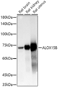 Anti-15-LOX-2 Antibody