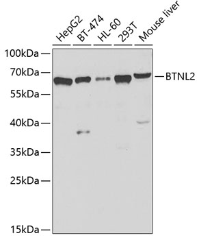 Anti-BTNL2 Antibody