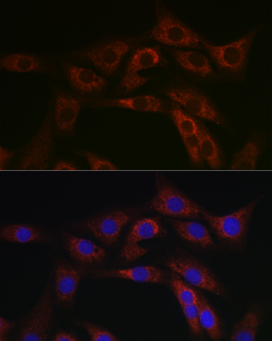 Anti-ABCA1 Antibody