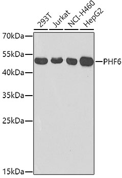 Anti-PHD finger protein 6 / PHF6 Antibody