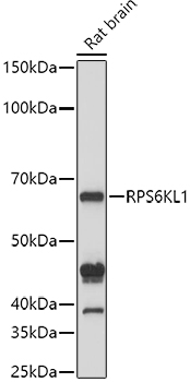 Anti-RPS6KL1 Antibody