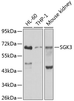 Anti-SGK3 Antibody