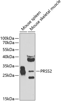 Anti-PRSS2 Antibody