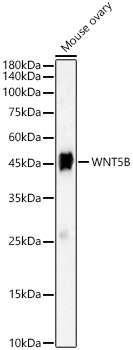 Anti-Wnt5b Antibody