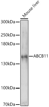 Anti-ABCB11 / BSEP Antibody