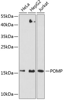 Anti-Proteasome maturation protein Antibody