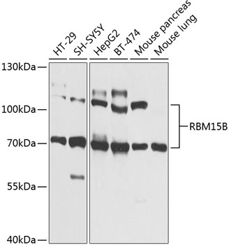 Anti-RBM15B Antibody