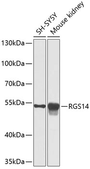 Anti-RGS14 Antibody