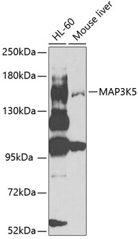 Anti-ASK1 Antibody