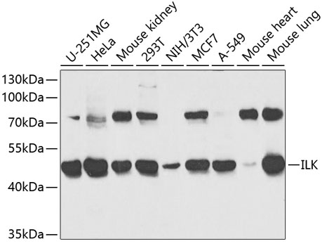 Anti-Integrin linked ILK Antibody