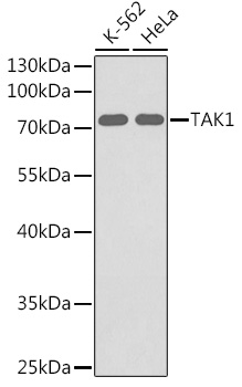 Anti-TAK1 Antibody