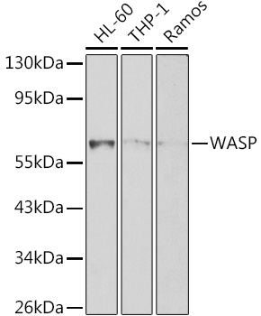 Anti-WASP / Wiskott-Aldrich syndrome protein Antibody