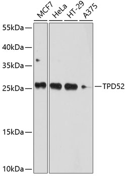 Anti-TPD52 Antibody