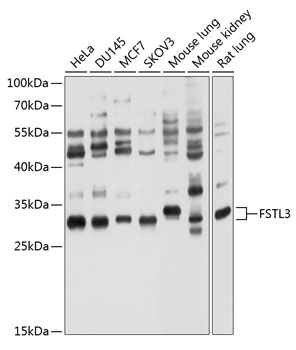 Anti-FSTL3 Antibody
