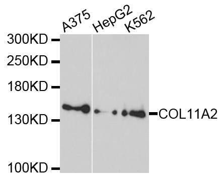 Anti-COL11A2 Antibody
