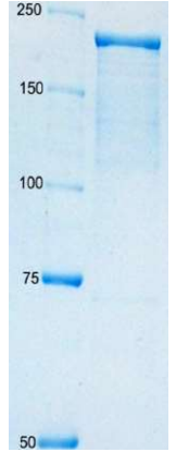 Recombinant Bordetella pertussis Adenylate Cyclase Protein (Functional)