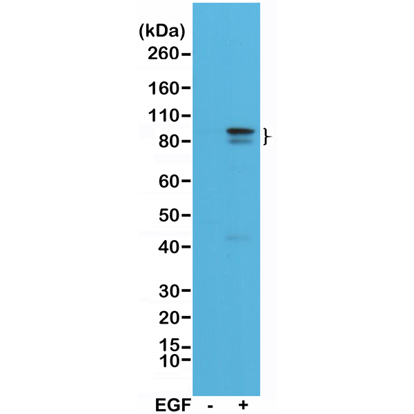 Anti-STAT3 (phospho Tyr705) Antibody [RM261]