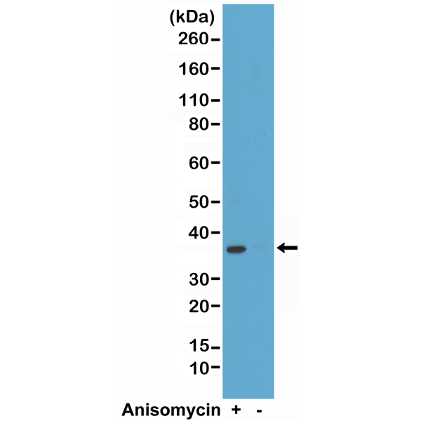 Anti-p38 MAPK (phospho Thr180 + Tyr182) Antibody [RM243]