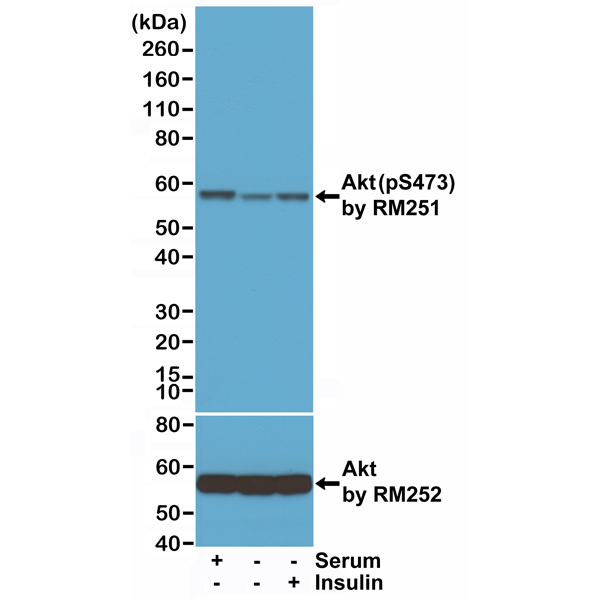 Anti-AKT (phospho Ser473) Antibody [RM251]