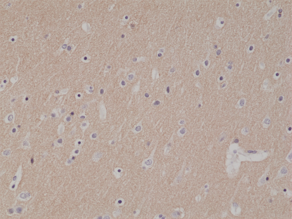 Anti-CD56 Antibody [RM315]