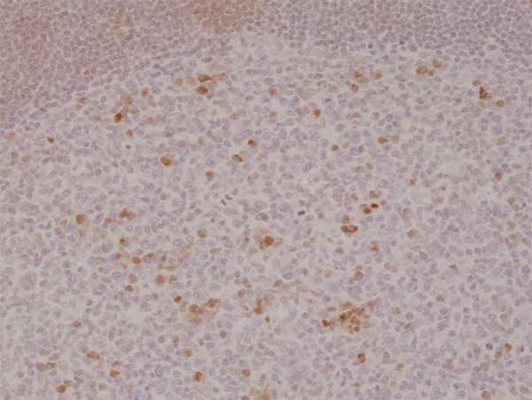 Anti-CD134 Antibody [RM313]