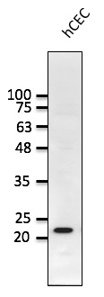 Anti-RAB1B Antibody