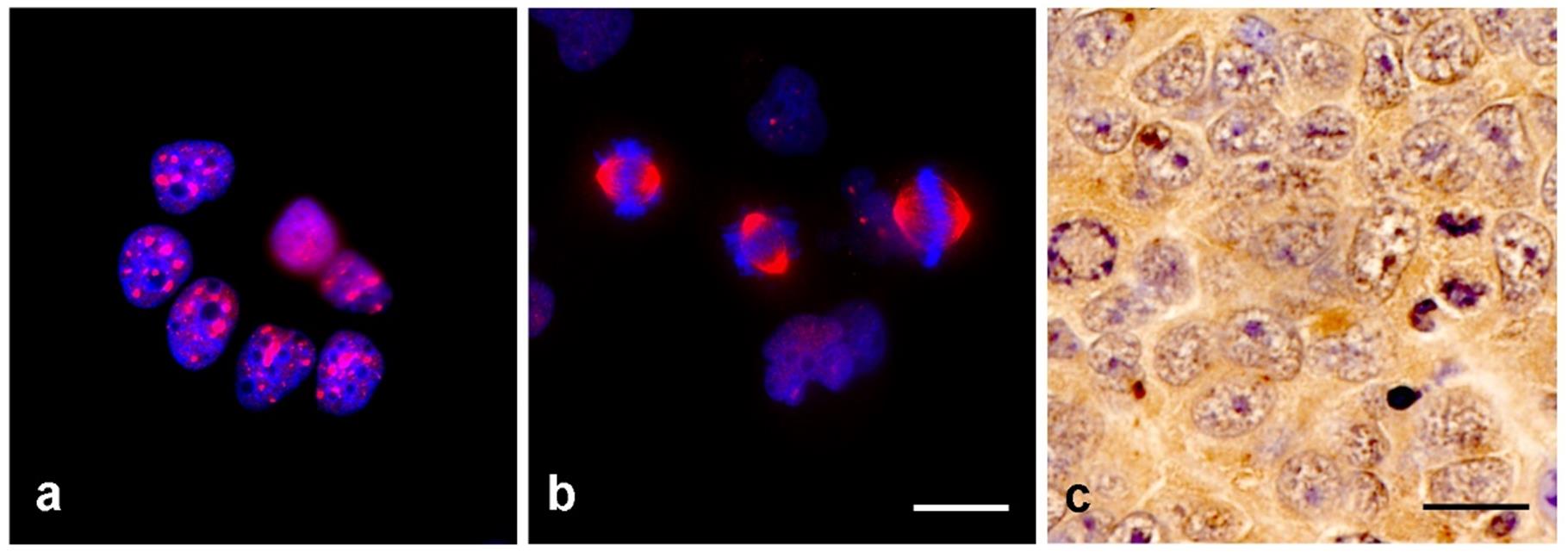 Anti-TPX2 Antibody [TPX2-01]