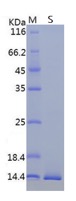 Recombinant ORF8 Protein (a.a. 16-121) (His Tag)